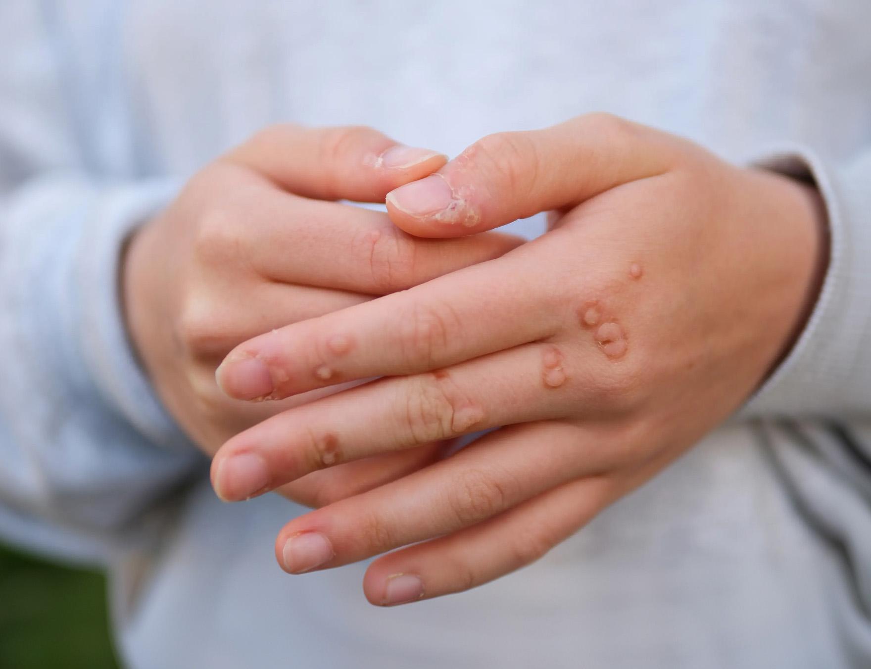 Warts & Many More image