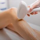 Laser Hair Removal