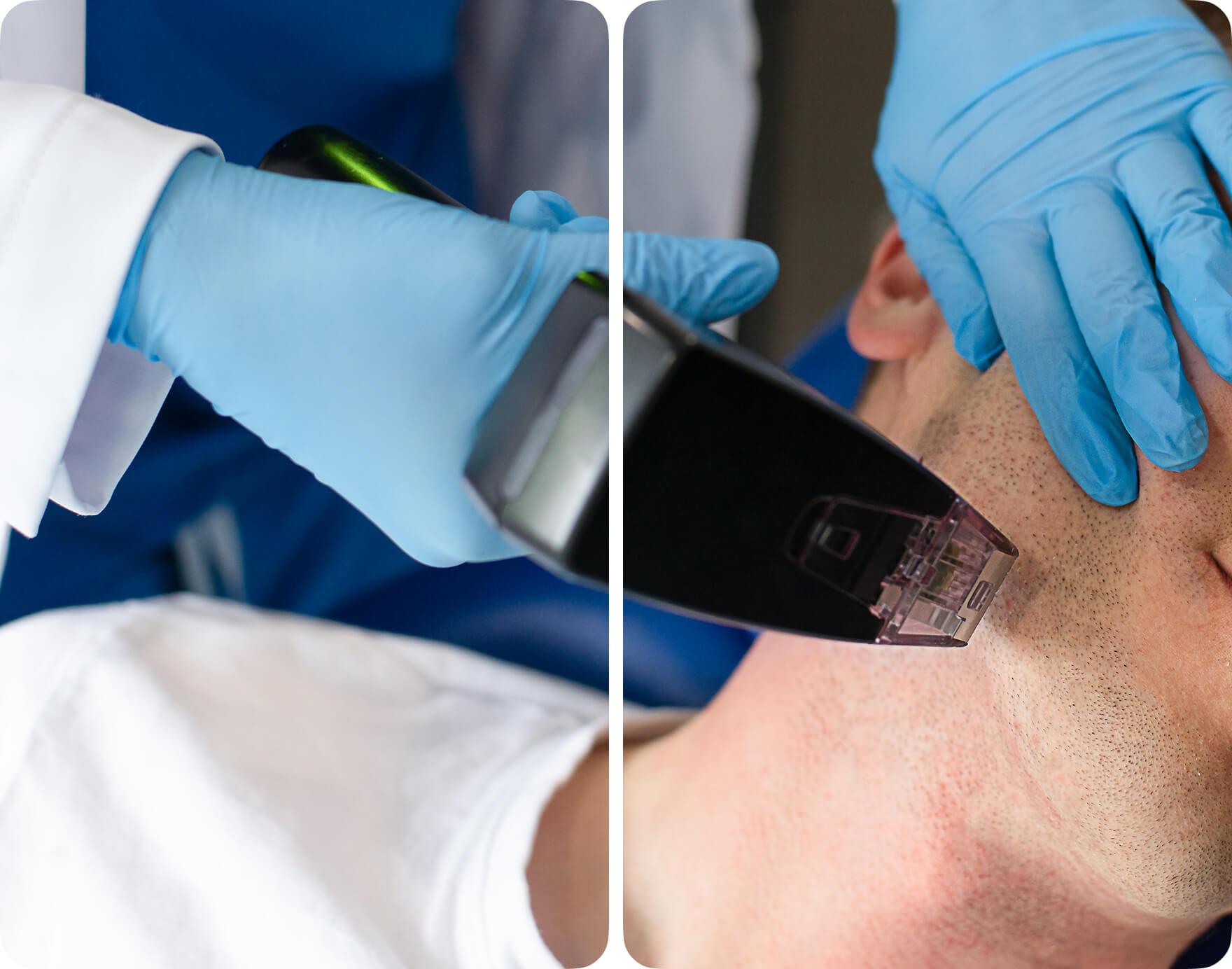 What Can Morpheus8 Treat?