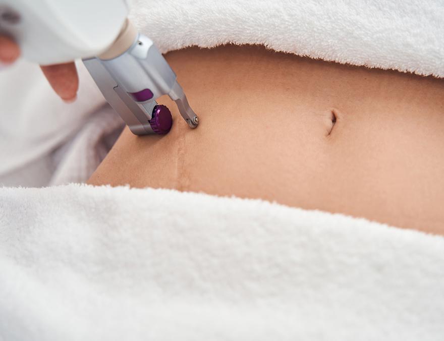 Scars image