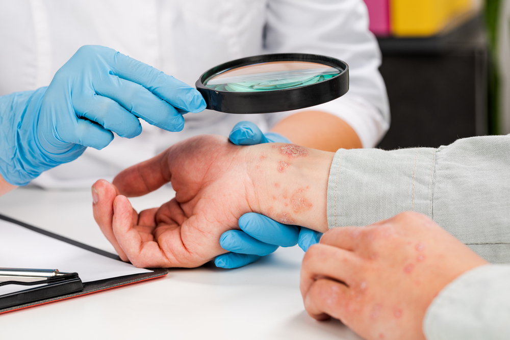 How Medical Dermatology Can Help You Manage Your Psoriasis